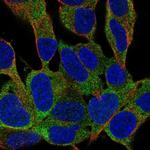 FAM59B Polyclonal Antibody