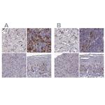 Cyclin F Polyclonal Antibody