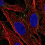 LCTL Polyclonal Antibody