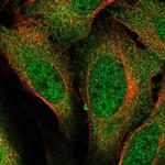 RMP Polyclonal Antibody