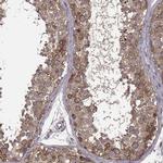 RMP Antibody in Immunohistochemistry (IHC)
