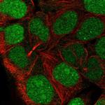 CCDC84 Polyclonal Antibody