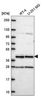 CCDC84 Antibody in Western Blot (WB)