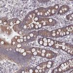 MRPS27 Polyclonal Antibody