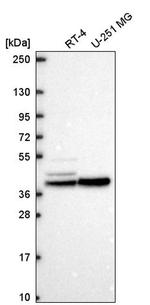 KCNJ14 Antibody in Western Blot (WB)