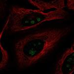 FOXL2NB Antibody in Immunocytochemistry (ICC/IF)