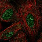 LHX8 Polyclonal Antibody