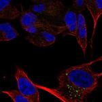 CACNA2D2 Polyclonal Antibody