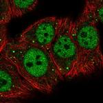 MED26 Antibody in Immunocytochemistry (ICC/IF)