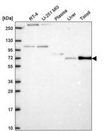 ZNF167 Antibody in Western Blot (WB)