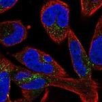 SMIM17 Antibody in Immunocytochemistry (ICC/IF)
