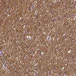 SMIM17 Antibody in Immunohistochemistry (IHC)