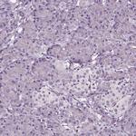 SMIM17 Antibody in Immunohistochemistry (IHC)
