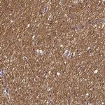 SMIM17 Antibody in Immunohistochemistry (IHC)
