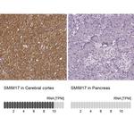 SMIM17 Antibody