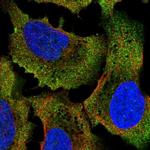 COQ7 Polyclonal Antibody