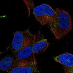MYO16 Polyclonal Antibody