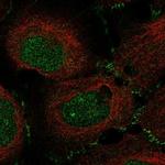 ZPK Polyclonal Antibody