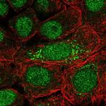 DOPEY2 Polyclonal Antibody