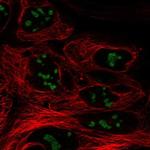 CC2D2B Polyclonal Antibody