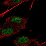 HOXC9 Polyclonal Antibody