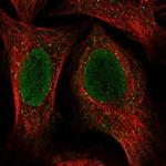 Cytokeratin 34 Polyclonal Antibody