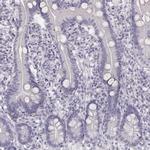 Cytokeratin 34 Antibody in Immunohistochemistry (IHC)
