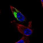 NDUFA11 Polyclonal Antibody