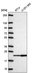NDUFA11 Antibody in Western Blot (WB)
