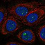 TAF1C Polyclonal Antibody