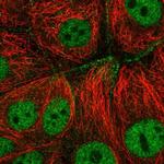 C6orf165 Polyclonal Antibody