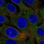 RABGAP1 Polyclonal Antibody