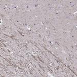 SNTG1 Polyclonal Antibody