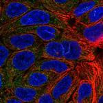 KCNMB4 Polyclonal Antibody