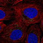 ROS1 Polyclonal Antibody