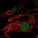 ZNF696 Polyclonal Antibody