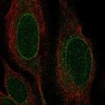 Nurim Polyclonal Antibody