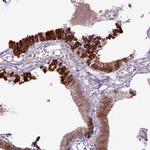 DEPDC1B Antibody in Immunohistochemistry (IHC)