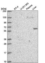 DEPDC1B Antibody in Western Blot (WB)