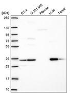 TMEM183A Antibody in Western Blot (WB)