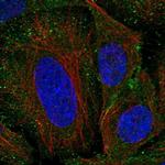 SHFM1 Polyclonal Antibody