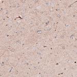 SLC16A2 Antibody in Immunohistochemistry (IHC)