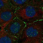 FBLIM1 Polyclonal Antibody