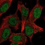 GATAD1 Polyclonal Antibody