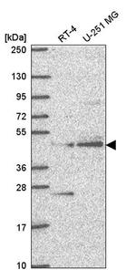 ETNPPL Isoform 1 Antibody in Western Blot (WB)