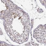 C10orf62 Polyclonal Antibody