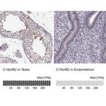 C10orf62 Antibody