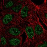 ZNF283 Polyclonal Antibody