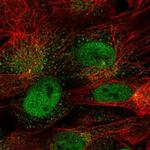 CDR1 Polyclonal Antibody