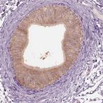 CLPSL1 Antibody in Immunohistochemistry (IHC)